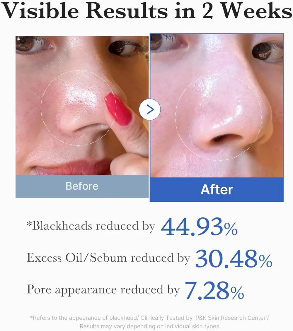 Medicube Zero Pore Toner Pads