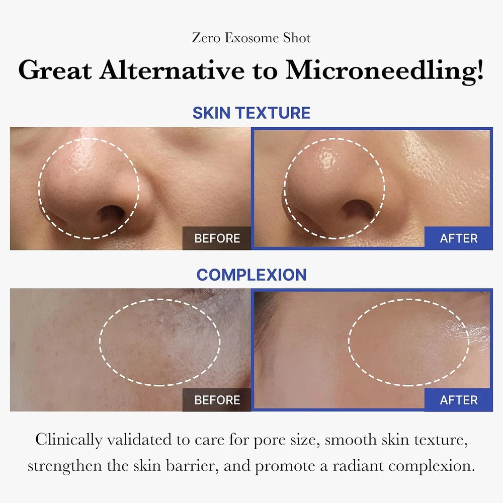 Medicube Pore Smoothing Trio