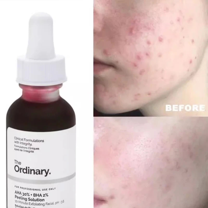 AHA BHA Exfoliating Facial Peel